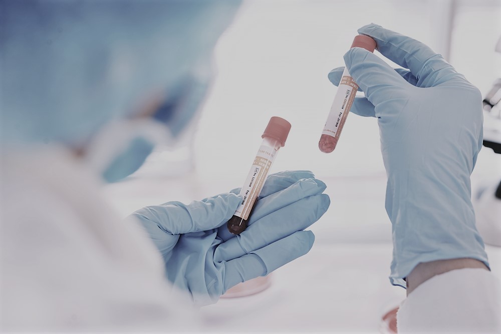 Misstanke om sköldkörtelsjukdom