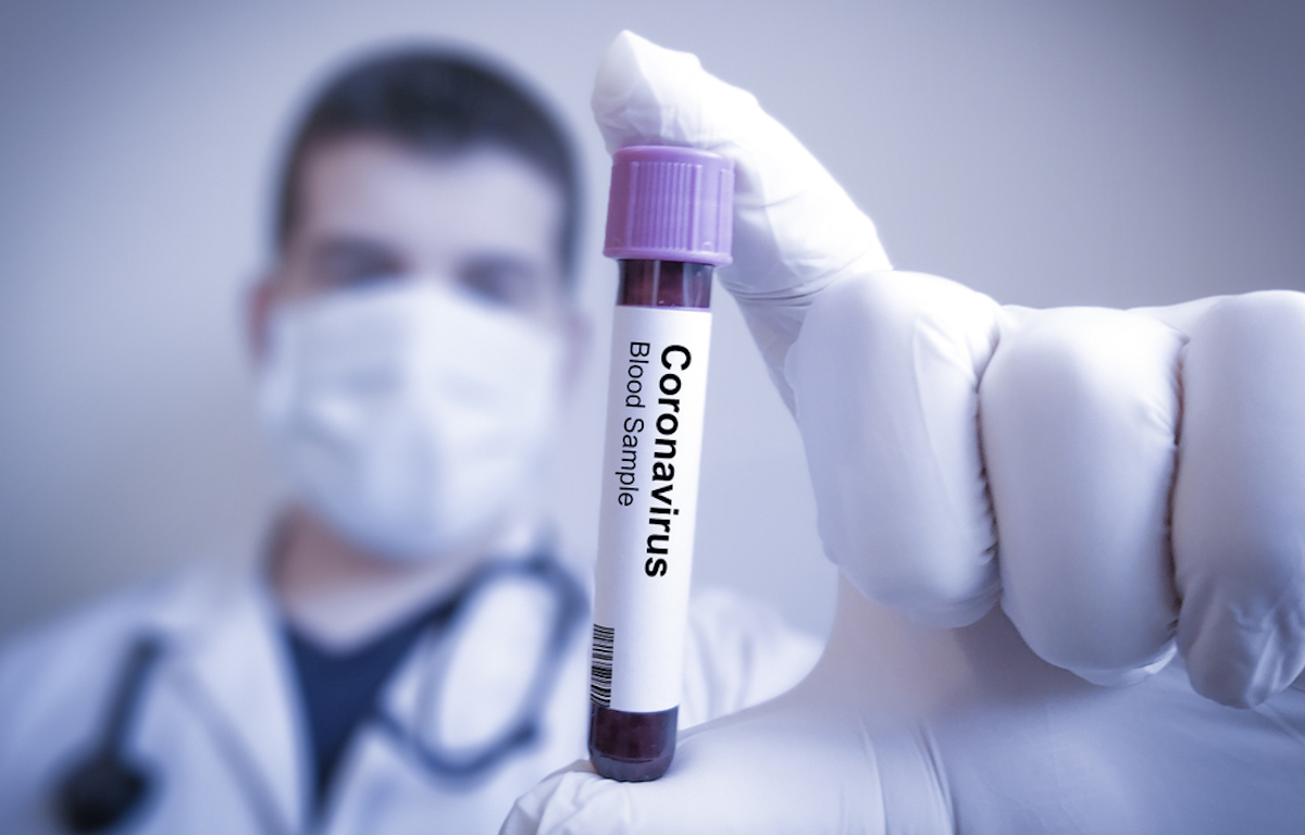 Corona test via blodprov