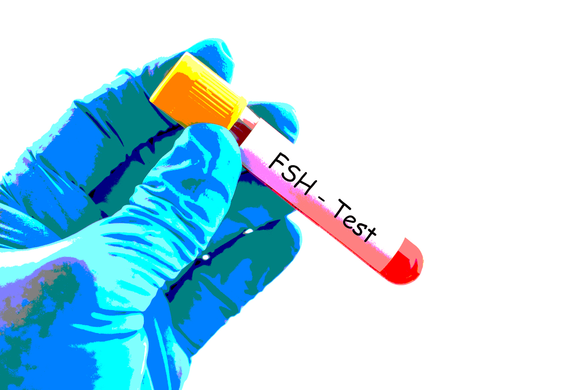 FSH och blodprov