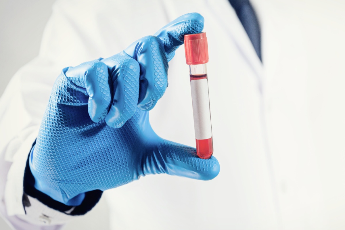 Hälsoundersökning för företag via blodprov