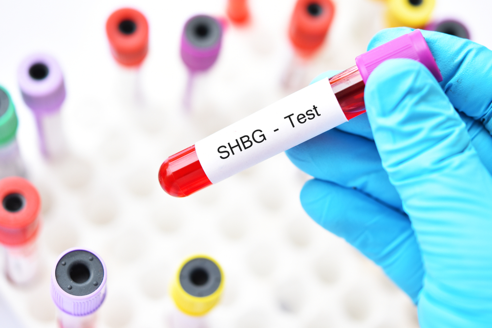 SHBG blodprov testosteronbrist testosteronöverskott