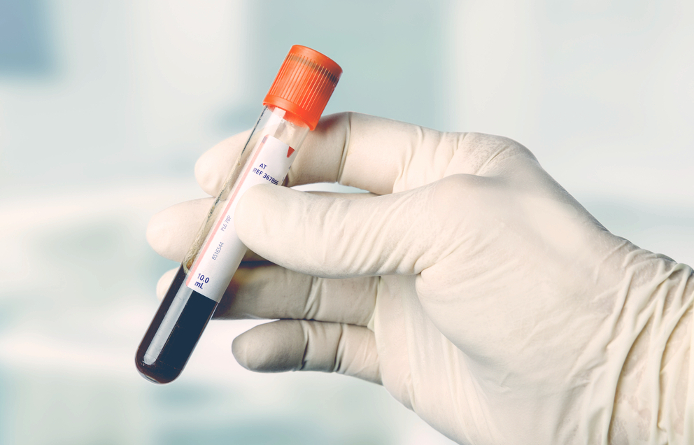 blodprov blodbrist symtom