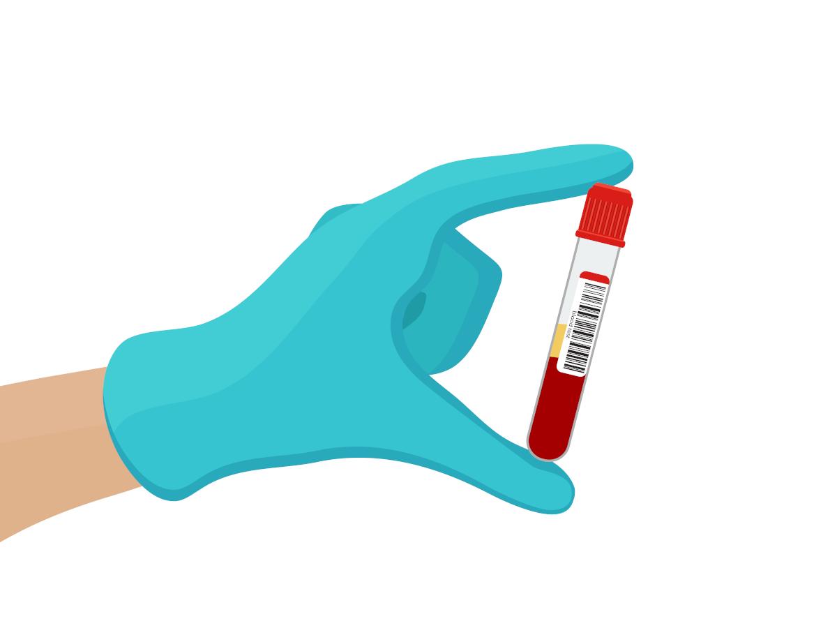 blodprov fördelar och nackdelar